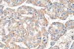 EDC4 Antibody in Immunohistochemistry (Paraffin) (IHC (P))