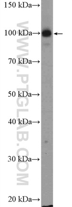 CPSF2 Antibody in Western Blot (WB)