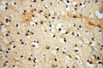 CHST14 Antibody in Immunohistochemistry (Paraffin) (IHC (P))