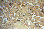 CHST14 Antibody in Immunohistochemistry (Paraffin) (IHC (P))