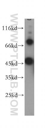 CHST14 Antibody in Western Blot (WB)