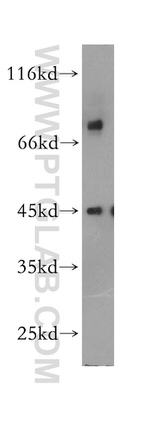 CHST14 Antibody in Western Blot (WB)