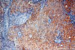 LSG1 Antibody in Immunohistochemistry (Paraffin) (IHC (P))