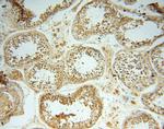 LSG1 Antibody in Immunohistochemistry (Paraffin) (IHC (P))