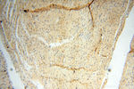 RANBP9 Antibody in Immunohistochemistry (Paraffin) (IHC (P))