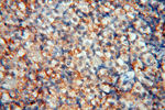 RANBP9 Antibody in Immunohistochemistry (Paraffin) (IHC (P))