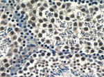 RANBP9 Antibody in Immunohistochemistry (Paraffin) (IHC (P))