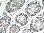 RANBP9 Antibody in Immunohistochemistry (Paraffin) (IHC (P))