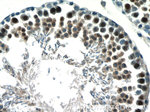 RANBP9 Antibody in Immunohistochemistry (Paraffin) (IHC (P))