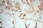 RANBP9 Antibody in Immunohistochemistry (Paraffin) (IHC (P))