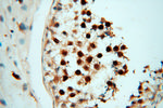 RANBP9 Antibody in Immunohistochemistry (Paraffin) (IHC (P))