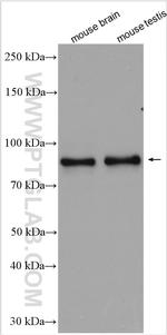 RANBP9 Antibody in Western Blot (WB)