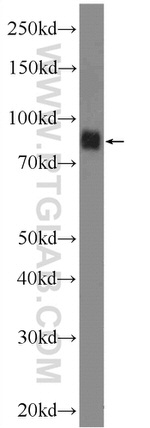 RANBP9 Antibody in Western Blot (WB)