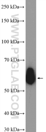 CORO1A Antibody in Western Blot (WB)