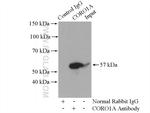 CORO1A Antibody in Immunoprecipitation (IP)