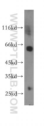 CORO1A Antibody in Western Blot (WB)