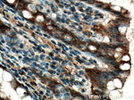 GM-CSF Antibody in Immunohistochemistry (Paraffin) (IHC (P))