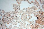 GM-CSF Antibody in Immunohistochemistry (Paraffin) (IHC (P))