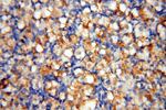 GM-CSF Antibody in Immunohistochemistry (Paraffin) (IHC (P))