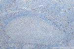 GM-CSF Antibody in Immunohistochemistry (Paraffin) (IHC (P))