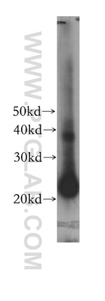 GM-CSF Antibody in Western Blot (WB)