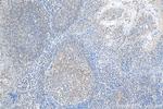 TLR3 Antibody in Immunohistochemistry (Paraffin) (IHC (P))