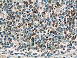 TLR3 Antibody in Immunohistochemistry (Paraffin) (IHC (P))