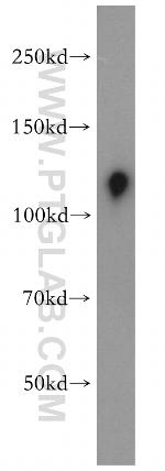 USP38 Antibody in Western Blot (WB)