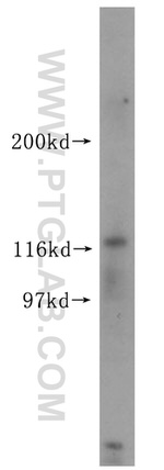 USP38 Antibody in Western Blot (WB)