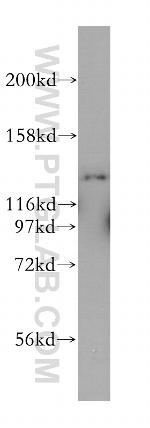 MYO1E Antibody in Western Blot (WB)