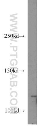 MYO1E Antibody in Western Blot (WB)