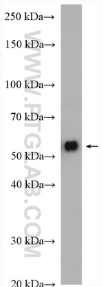 CACNB4 Antibody in Western Blot (WB)