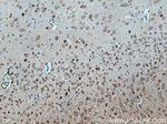 CACNB4 Antibody in Immunohistochemistry (Paraffin) (IHC (P))