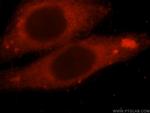 PDE7B Antibody in Immunocytochemistry (ICC/IF)