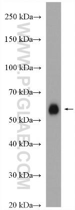 NOX1 Antibody in Western Blot (WB)