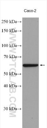 NOX1 Antibody in Western Blot (WB)