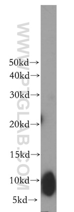 UCRC Antibody in Western Blot (WB)