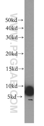 UCRC Antibody in Western Blot (WB)