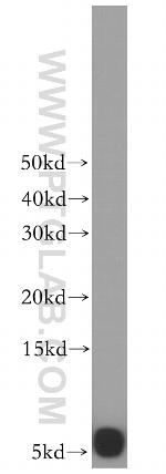 UCRC Antibody in Western Blot (WB)