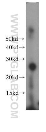 ORC6 Antibody in Western Blot (WB)