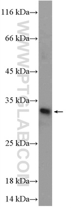 ORC6 Antibody in Western Blot (WB)