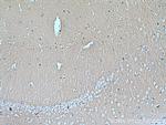 Synaptophysin Antibody in Immunohistochemistry (Paraffin) (IHC (P))