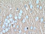 Synaptophysin Antibody in Immunohistochemistry (Paraffin) (IHC (P))