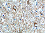 Synaptophysin Antibody in Immunohistochemistry (Paraffin) (IHC (P))