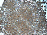 Synaptophysin Antibody in Immunohistochemistry (Paraffin) (IHC (P))