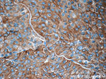 Synaptophysin Antibody in Immunohistochemistry (Paraffin) (IHC (P))