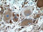 Synaptophysin Antibody in Immunohistochemistry (Paraffin) (IHC (P))