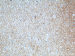 Synaptophysin Antibody in Immunohistochemistry (Paraffin) (IHC (P))