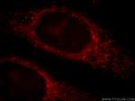 MAPKBP1 Antibody in Immunocytochemistry (ICC/IF)