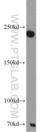 MAPKBP1 Antibody in Western Blot (WB)